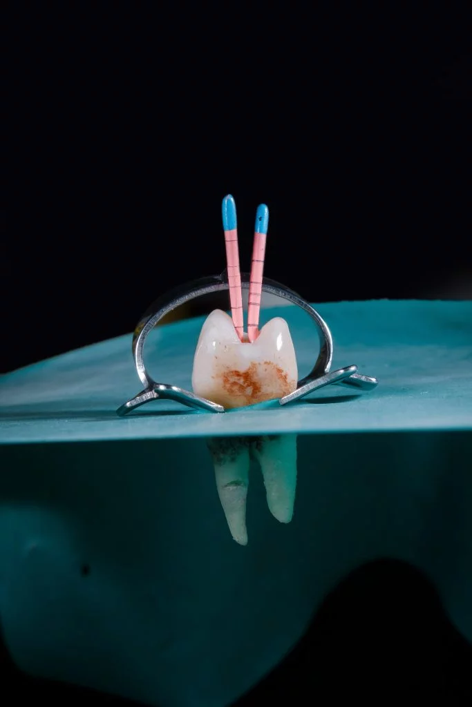 Endodoncja