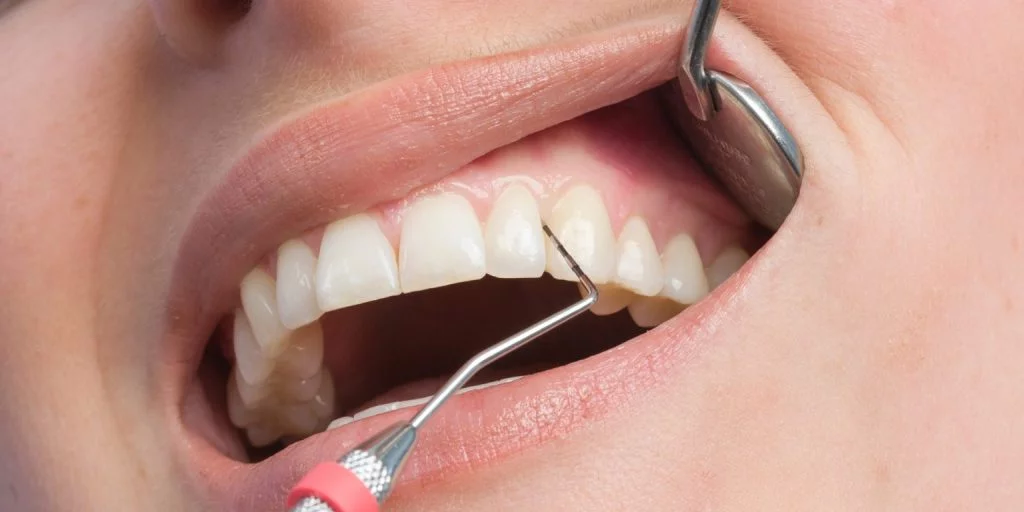 Periodontologia